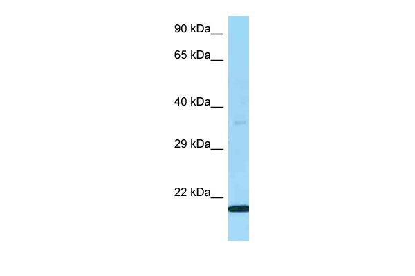 WB Suggested Anti-LY6G5B Antibody Titration: 1.0 ug/ml Positive Control: Fetal Lung