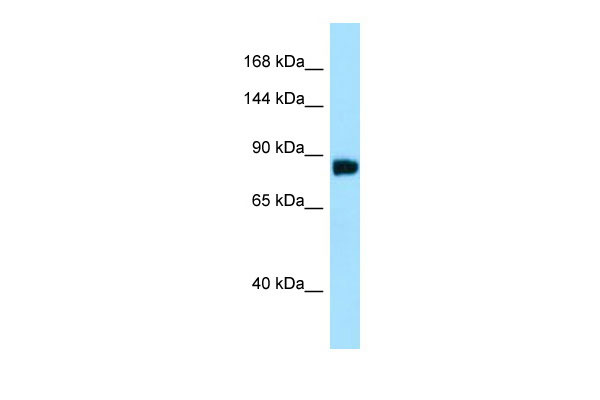 Host: Rabbit Target Name: C11orf82 Sample Tissue: HepG2 Whole Cell lysates Antibody Dilution: 1.0ug/ml
