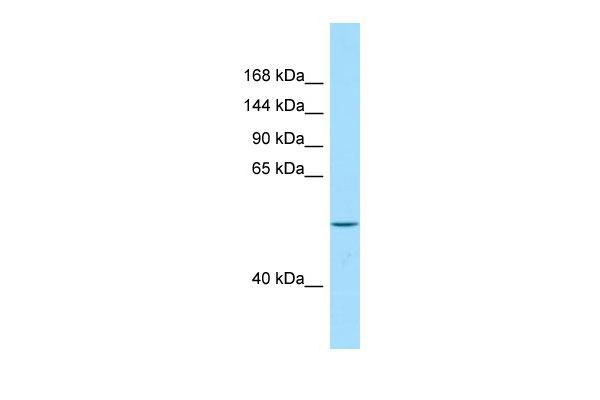 WB Suggested Anti-VPS13B Antibody Titration: 1.0 ug/ml Positive Control: Fetal Heart