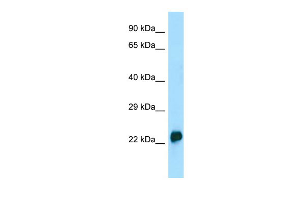 WB Suggested Anti-CRYGA Antibody Titration: 1.0 ug/ml Positive Control: HCT15 Whole Cell