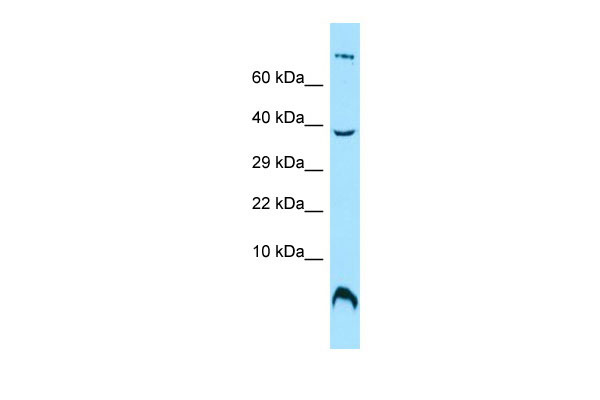 WB Suggested Anti-OST4 Antibody Titration: 1.0 ug/ml Positive Control: MCF7 Whole Cell