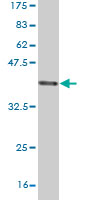 Antibody Reactive Against Recombinant Protein.Western Blot detection against Immunogen (36.74 KDa) . 