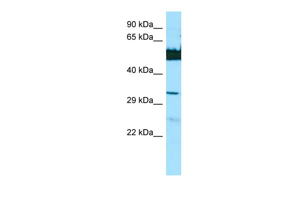 WB Suggested Anti-LGSN Antibody Titration: 1.0 ug/ml Positive Control: HepG2 Whole Cell