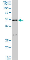 SCARA3 monoclonal antibody (M01), clone 3A2. Western Blot analysis of SCARA3 expression in PC-12((Cat # AT3783a )