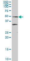 SCARA3 monoclonal antibody (M01), clone 3A2. Western Blot analysis of SCARA3 expression in HepG2 ( (Cat # AT3783a )