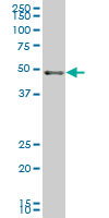 SCARA3 monoclonal antibody (M01), clone 3A2 Western Blot analysis of SCARA3 expression in IMR-32 ( (Cat # AT3783a )