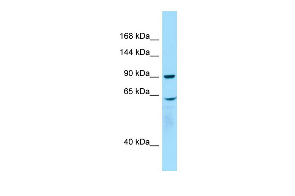 WB Suggested Anti-WHAMM Antibody Titration: 1.0 ug/ml Positive Control: Placenta