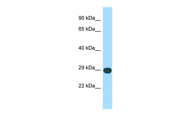 WB Suggested Anti-LRRC10 Antibody Titration: 1.0 ug/ml Positive Control: PANC1 Whole Cell