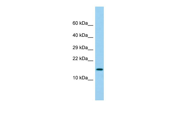 Host: Rabbit Target Name: LY6G6D Sample Tissue: Fetal Lung lysates Antibody Dilution: 1.0ug/ml