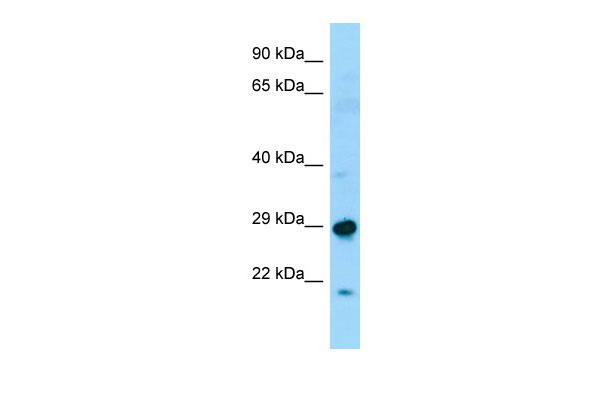 WB Suggested Anti-SPAG7 Antibody Titration: 1.0 ug/ml Positive Control: Fetal Liver