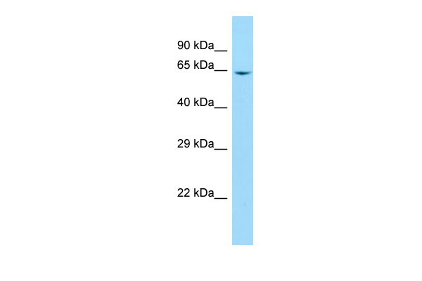 Host: Rabbit Target Name: B4GALNT2 Sample Tissue: Jurkat Whole Cell lysates Antibody Dilution: 1.0ug/ml