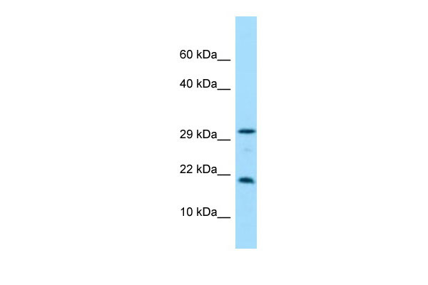 WB Suggested Anti-CRYGN Antibody Titration: 1.0 ug/ml Positive Control: Hela Whole cell