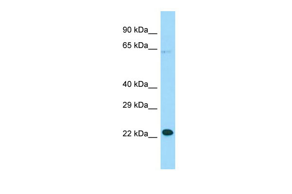 WB Suggested Anti-MOSPD1 Antibody Titration: 1.0 ug/ml Positive Control: Hela Whole Cell