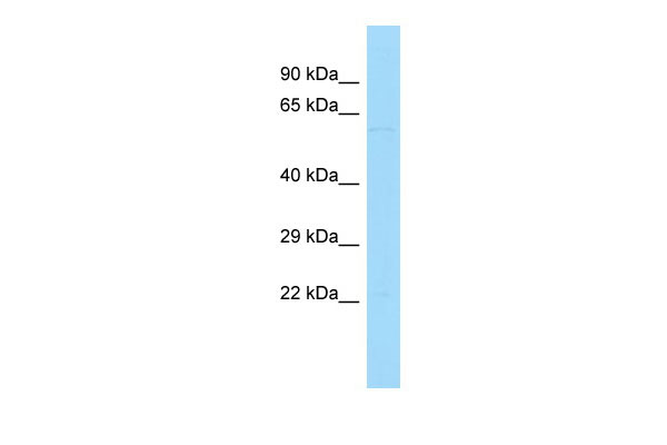 Host: Rabbit Target Name: PATL2 Sample Tissue: Hela Whole Cell lysates Antibody Dilution: 1.0ug/ml