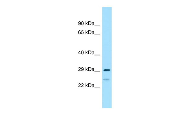 WB Suggested Anti-RPS4Y2 Antibody Titration: 1.0 ug/ml Positive Control: 721_B Whole Cell