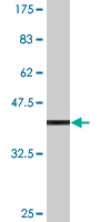 Antibody Reactive Against Recombinant Protein.Western Blot detection against Immunogen (37.84 KDa) . 