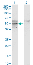 Western Blot analysis of SC65 expression in transfected 293T cell line by SC65 monoclonal antibody (M01), clone 1E12.Lane 1: SC65 transfected lysate (Predicted MW: 50.381 KDa).Lane 2: Non-transfected lysate.