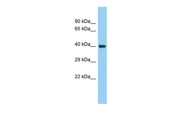 Host: Rabbit Target Name: C4orf17 Sample Tissue: Placenta lysates Antibody Dilution: 1.0ug/ml