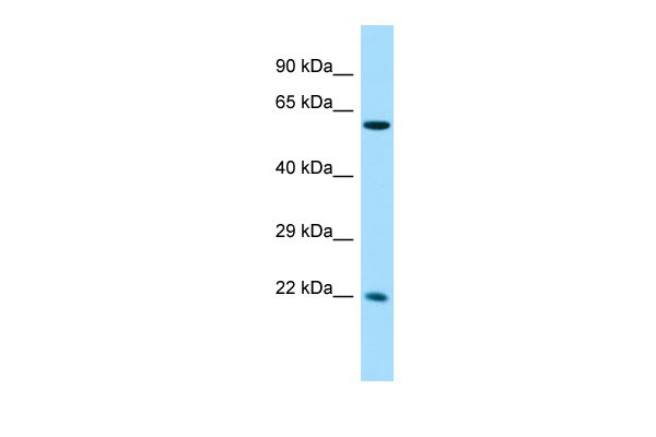 Host: Rabbit Target Name: CCDC85A Sample Tissue: Fetal Liver lysates Antibody Dilution: 1.0ug/ml