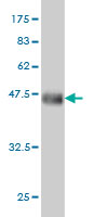 Antibody Reactive Against Recombinant Protein.Western Blot detection against Immunogen (36.74 KDa) . 