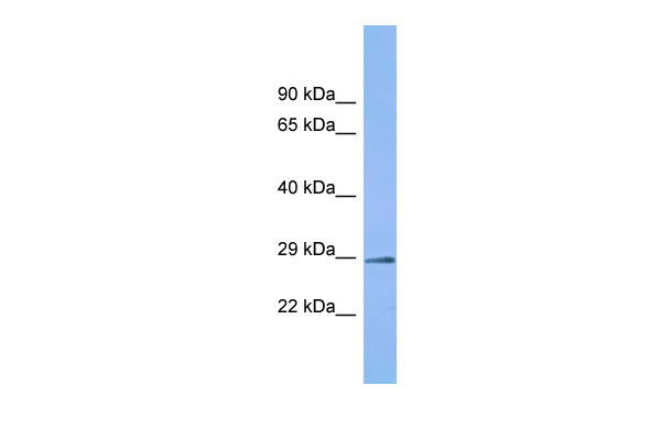 Host: Rabbit Target Name: C6orf203 Sample Tissue: Fetal Kidney lysates Antibody Dilution: 1.0ug/ml