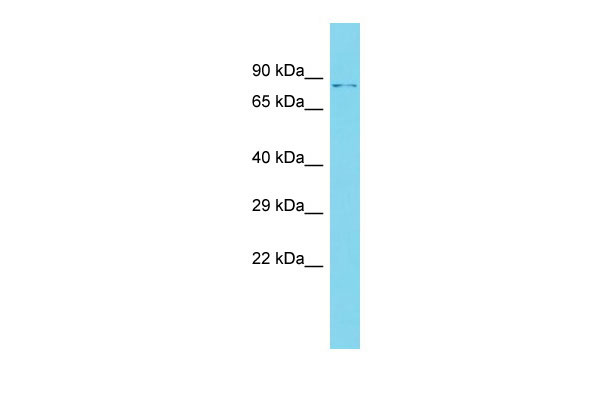 Host: Rabbit Target Name: DZANK1 Sample Tissue: OVCAR-3 Whole Cell lysates Antibody Dilution: 1.0ug/ml