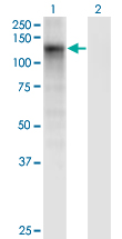 Western Blot analysis of DSE expression in transfected 293T cell line by DSE monoclonal antibody (M03), clone 6D4.Lane 1: DSE transfected lysate (Predicted MW: 109.8 KDa).Lane 2: Non-transfected lysate.