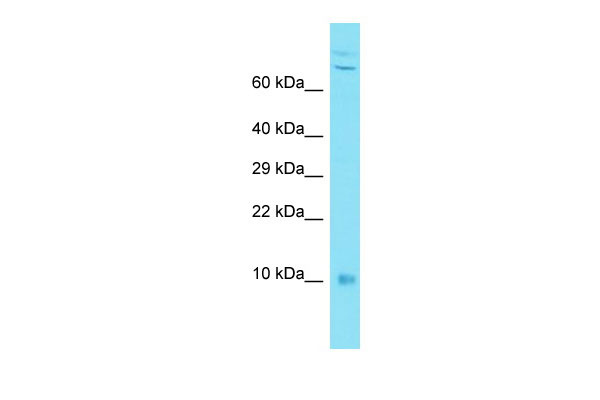 Host: Rabbit Target Name: C7orf49 Sample Tissue: MDA-MB-435S Whole Cell lysates Antibody Dilution: 1.0ug/mlC7orf49 is supported by BioGPS gene expression data to be expressed in MDA-MB435