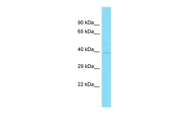 Host: Rabbit Target Name: C1orf198 Sample Tissue: NCI-H226 Whole Cell lysates Antibody Dilution: 1.0ug/ml