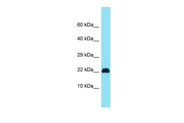 Host: Rabbit Target Name: C15orf32 Sample Tissue: Jurkat Whole Cell lysates Antibody Dilution: 1.0ug/ml