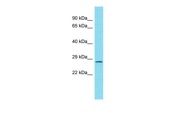 Host: Rabbit Target Name: C17orf77 Sample Tissue: RPMI-8226 Whole Cell lysates Antibody Dilution: 1.0ug/ml