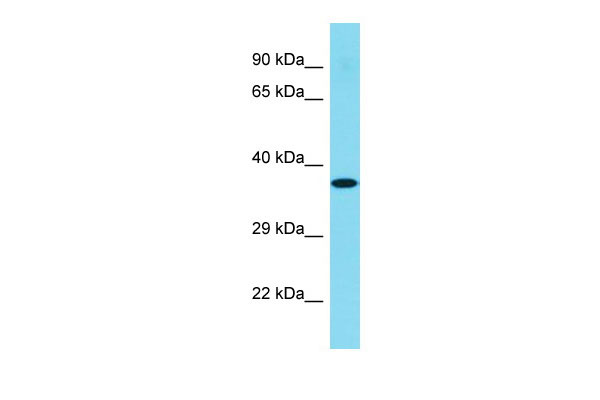 Host: Rabbit Target Name: C1orf168 Sample Tissue: Hela Whole cell lysates Antibody Dilution: 1.0ug/ml