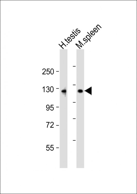 All lanes : Anti-PPP6R1 Antibody (Center) at 1:1000-1:2000 dilution Lane 1: human testis lysate Lane 2:mouse spleen lysate Lysates/proteins at 20 µg per lane. Secondary Goat Anti-Rabbit IgG, (H+L), Peroxidase conjugated at 1/10000 dilution. Predicted band size : 97 kDa Blocking/Dilution buffer: 5% NFDM/TBST.