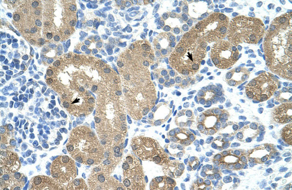 Rabbit Anti-TRNT1 Antibody Catalog Number: ARP40819 Paraffin Embedded Tissue: Human Kidney Cellular Data: Epithelial cells of renal tubule Antibody Concentration: 4.0-8.0 ug/ml Magnification: 400X