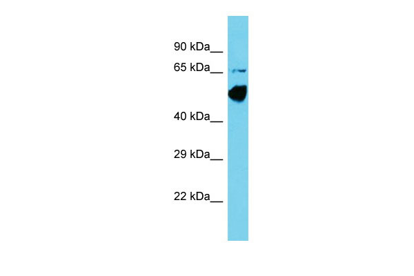Host: Rabbit Target Name: CCDC41 Sample Tissue: COLO205 Whole Cell lysates Antibody Dilution: 1.0ug/ml