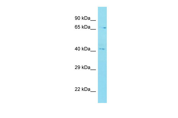 Host: Rabbit Target Name: C12orf56 Sample Tissue: MDA-MB-435S Whole Cell lysates Antibody Dilution: 1.0ug/ml
