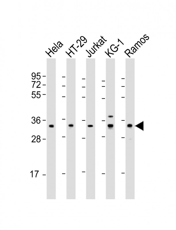 All lanes : Anti-SPPL2B Antibody (N-Term) at 1:2000 dilution Lane 1: Hela whole cell lysate Lane 2: HT-29 whole cell lysate Lane 3: Jurkat whole cell lysate Lane 4: KG-1 whole cell lysate Lane 5: Ramos whole cell lysate Lysates/proteins at 20 µg per lane. Secondary Goat Anti-Rabbit IgG, (H+L), Peroxidase conjugated at 1/10000 dilution. Predicted band size : 65 kDa Blocking/Dilution buffer: 5% NFDM/TBST.