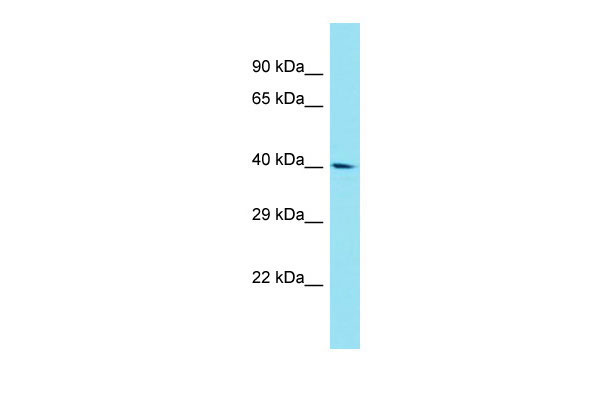 Host: Rabbit Target Name: FAM170A Sample Tissue: RPMI-8226 Whole Cell lysates Antibody Dilution: 1.0ug/ml