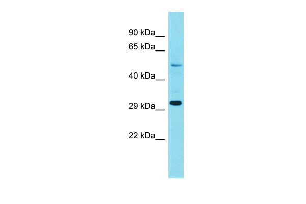 Host: Rabbit Target Name: FAM185A Sample Tissue: 293T Whole Cell lysates Antibody Dilution: 1.0ug/ml