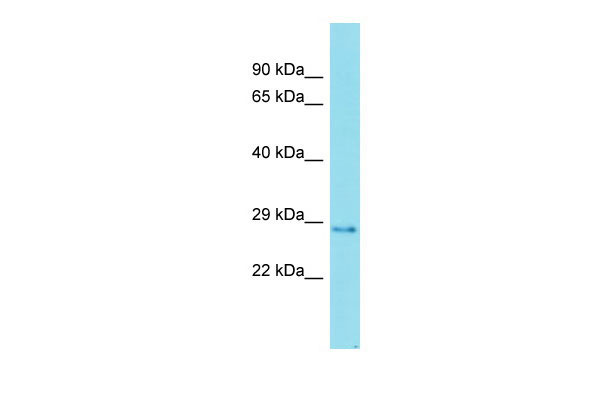 Host: Rabbit Target Name: FAM192A Sample Tissue: Placenta lysates Antibody Dilution: 1.0ug/ml