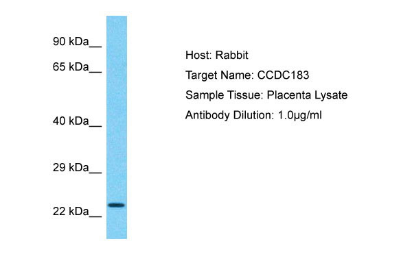 Host: Rabbit Target Name: CCDC183 Sample Tissue: Placenta lysates Antibody Dilution: 1.0ug/ml