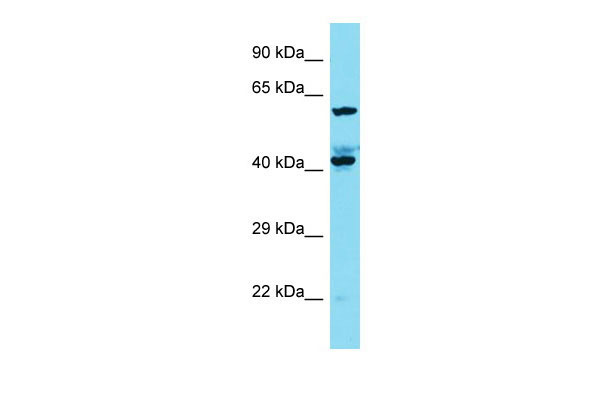 Host: Rabbit Target Name: KIAA1841 Sample Tissue: A549 Whole Cell lysates Antibody Dilution: 1.0ug/ml
