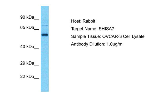 Host: Rabbit Target Name: SHISA7 Sample Tissue: OVCAR-3 Whole Cell lysates Antibody Dilution: 1.0ug/ml