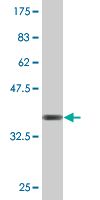 Antibody Reactive Against Recombinant Protein.Western Blot detection against Immunogen (37.07 KDa) . 