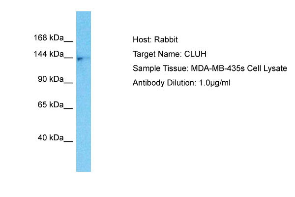 Host: Rabbit Target Name: CLUH Sample Tissue: MDA-MB-435s Whole Cell lysates Antibody Dilution: 1.0ug/ml