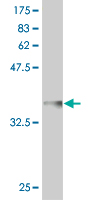Antibody Reactive Against Recombinant Protein.Western Blot detection against Immunogen (37 KDa) . 