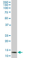 TOMM20 monoclonal antibody (M01), clone 4F3. Western Blot analysis of TOMM20 expression in PC-12 ( (Cat # AT4301a )