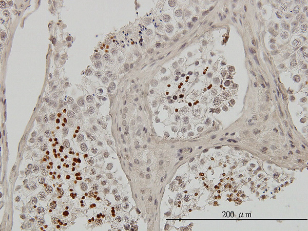 Immunoperoxidase of monoclonal antibody to TNP1 on formalin-fixed paraffin-embedded human testis. [antibody concentration 3 ug/ml]
