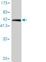 Antibody Reactive Against Recombinant Protein.Western Blot detection against Immunogen (60.17 KDa) . 