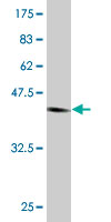 Antibody Reactive Against Recombinant Protein.Western Blot detection against Immunogen (45.65 KDa) . 